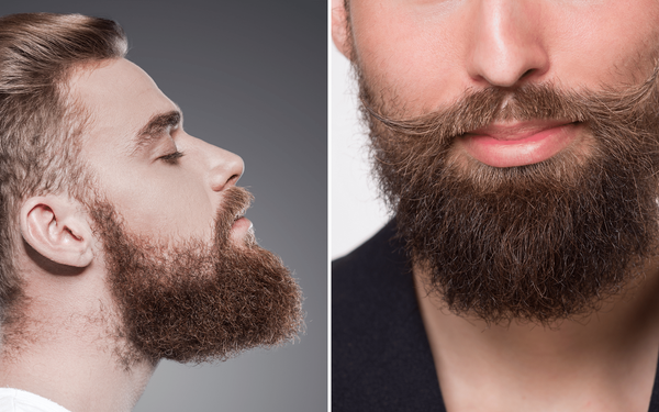 Beard Roller Kit  to Keep Your Beard Looking Great