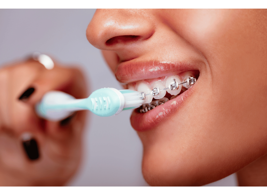 The Best Toothpaste For Braces: What To Look For